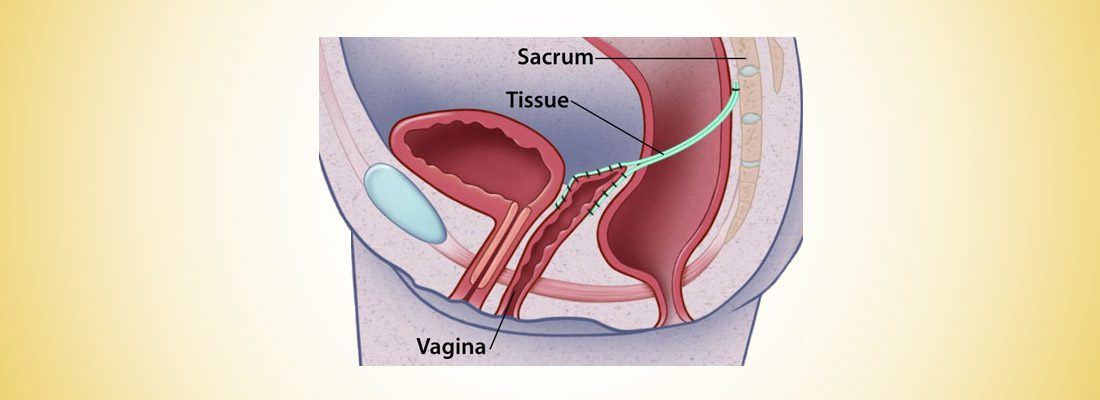 Three way fat lesbian sex tube If i am gay or straight