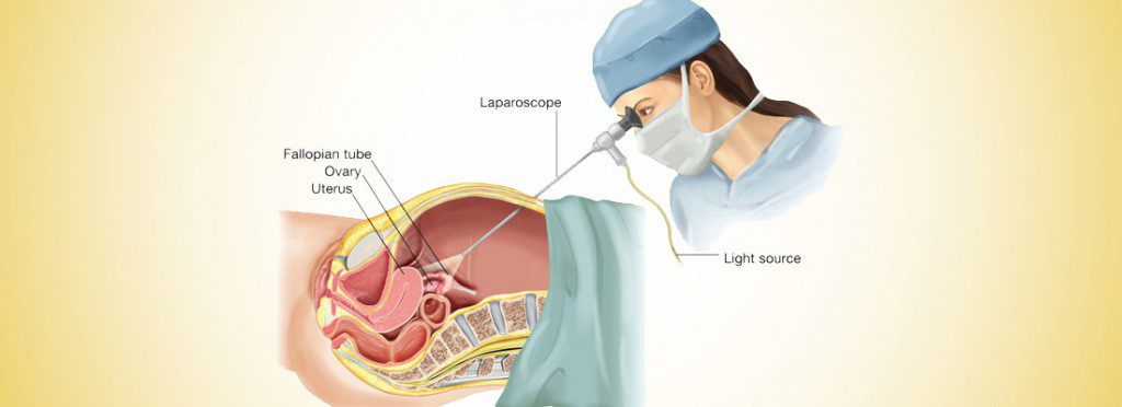 commands-before-laparoscopy-2